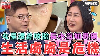 生活處處是危機！46歲女星收曬衣架遭蟲咬！臉上紅腫長超大水泡宛如燙傷！【#醫師好辣】20231111 完整版 親子檔現身說法 EP1582 鄭丞傑 柯世祐