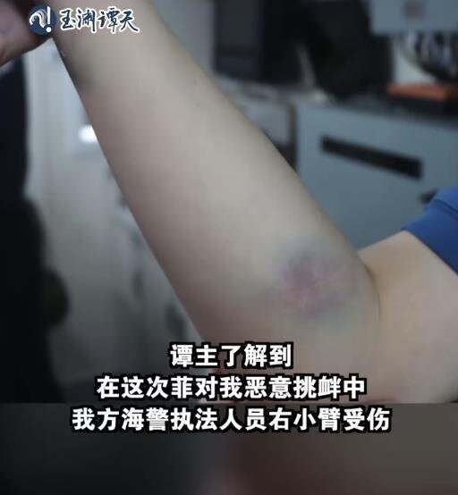 央視旗下「玉淵譚天」21日晚發文,「在這次菲對我惡意挑釁中,我方海警有執法人員右小臂受傷」。圖/取自玉淵譚天微博