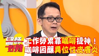 工作勞累靠咖啡提神!咖啡因中毒釀「異位性皮膚炎」?【#醫師好辣】20260103 EP1765 part3